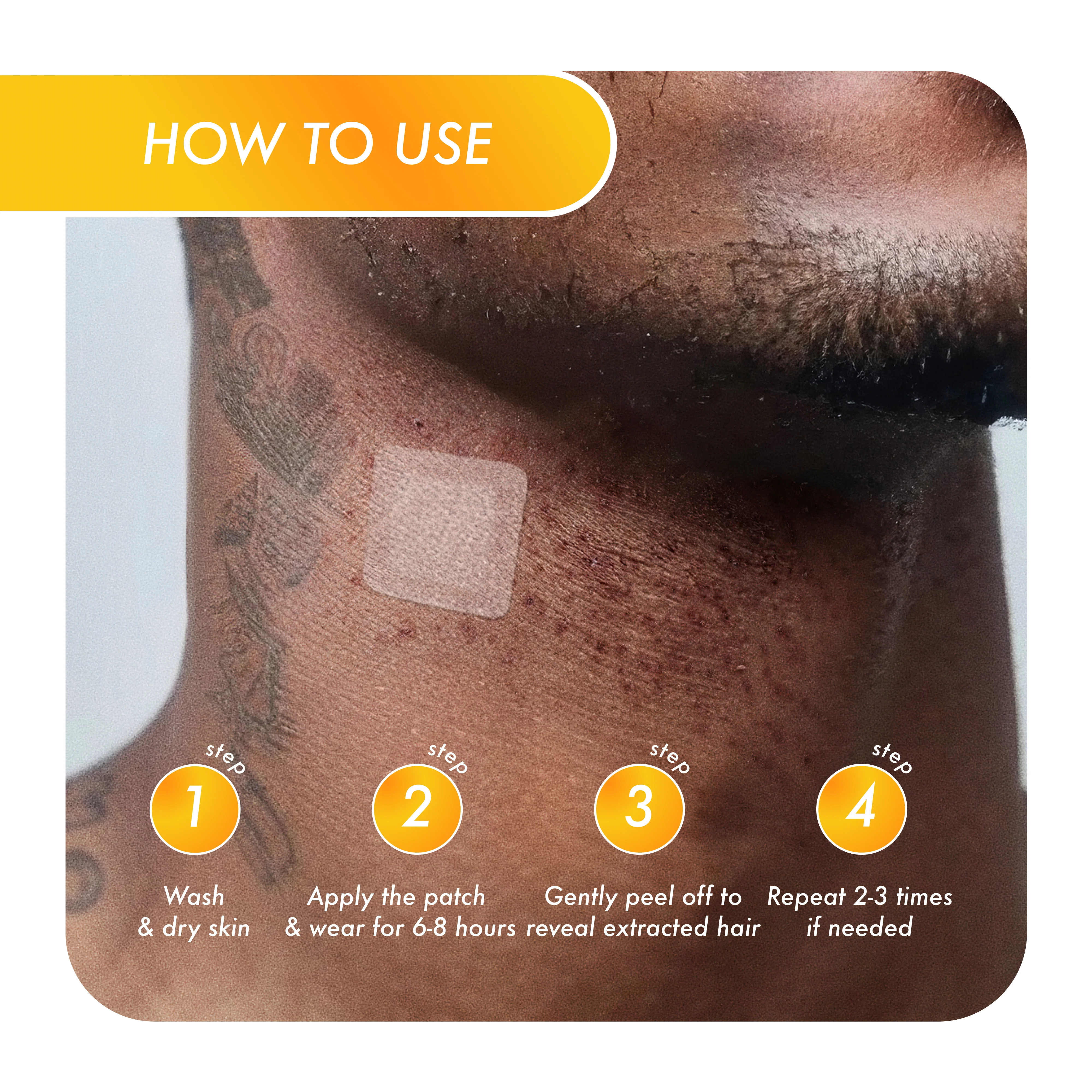 Ingrown Hair Face + Neck Beard Patch - Image 5